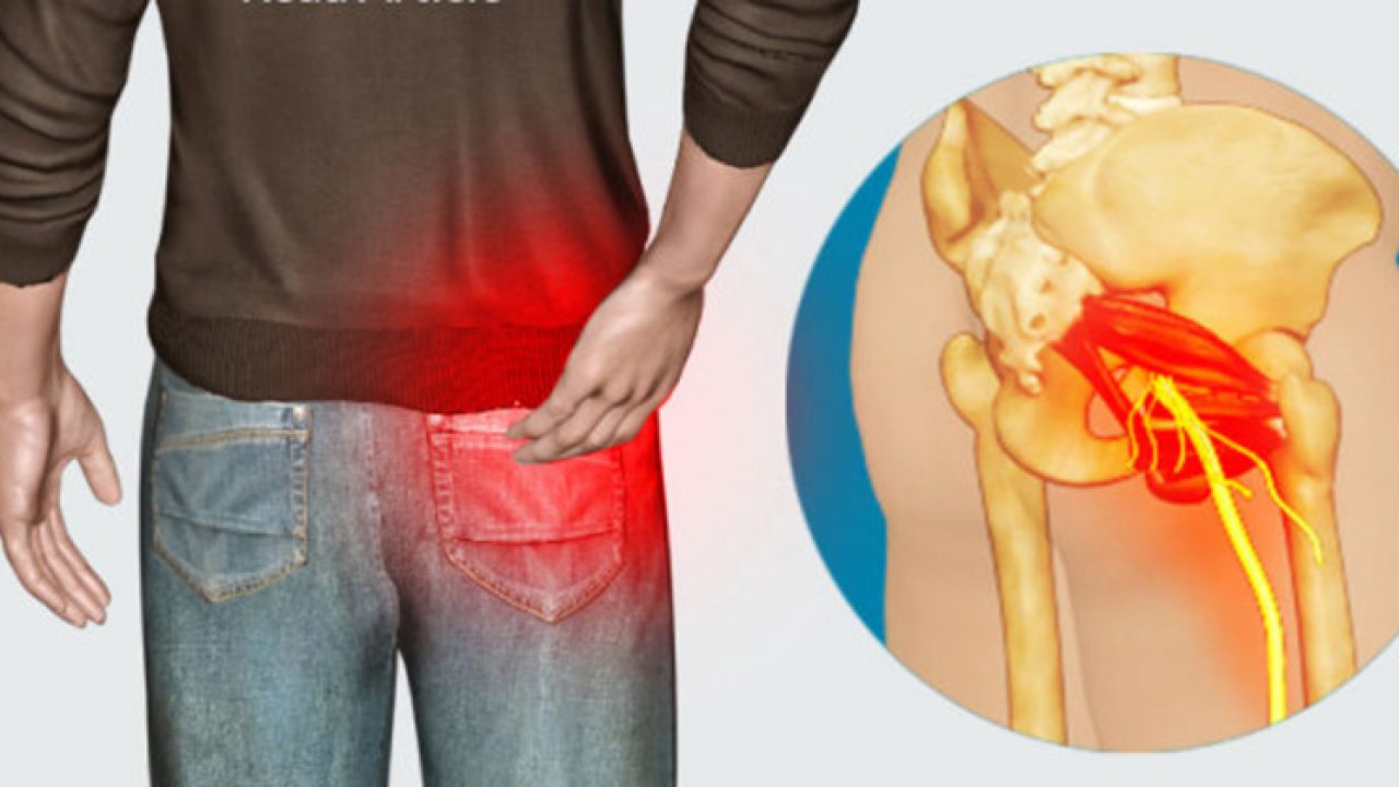 shower Offense decide 4 Tipuri de masaj care te ajuta sa scapi de durerea provocata de Sciatica - dr. Andrei Laslău shower Offense decide 4 Tipuri de masaj care te ajuta sa scapi de durerea provocata de Sciatica - dr. Andrei Laslău